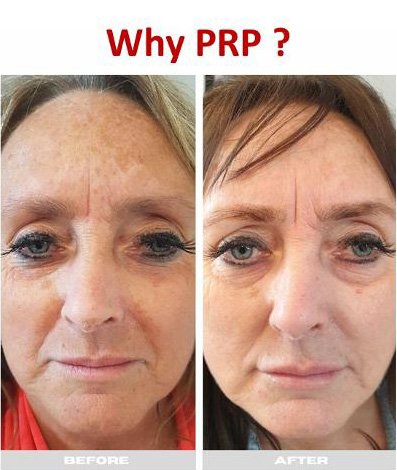  Advanced Aesthetics-  Enquiries:  Call us on 07711 122 951 