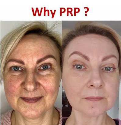  Advanced Aesthetics-  Enquiries:  Call us on 07711 122 951 