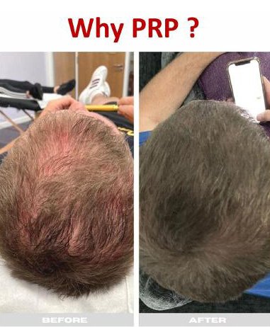  Advanced Aesthetics-  Enquiries:  Call us on 07711 122 951 