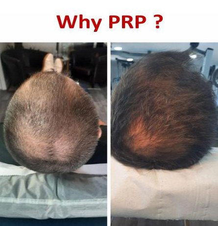  Advanced Aesthetics-  Enquiries:  Call us on 07711 122 951 