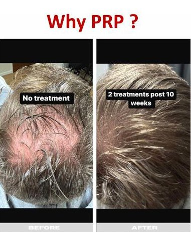  Advanced Aesthetics-  Enquiries:  Call us on 07711 122 951 